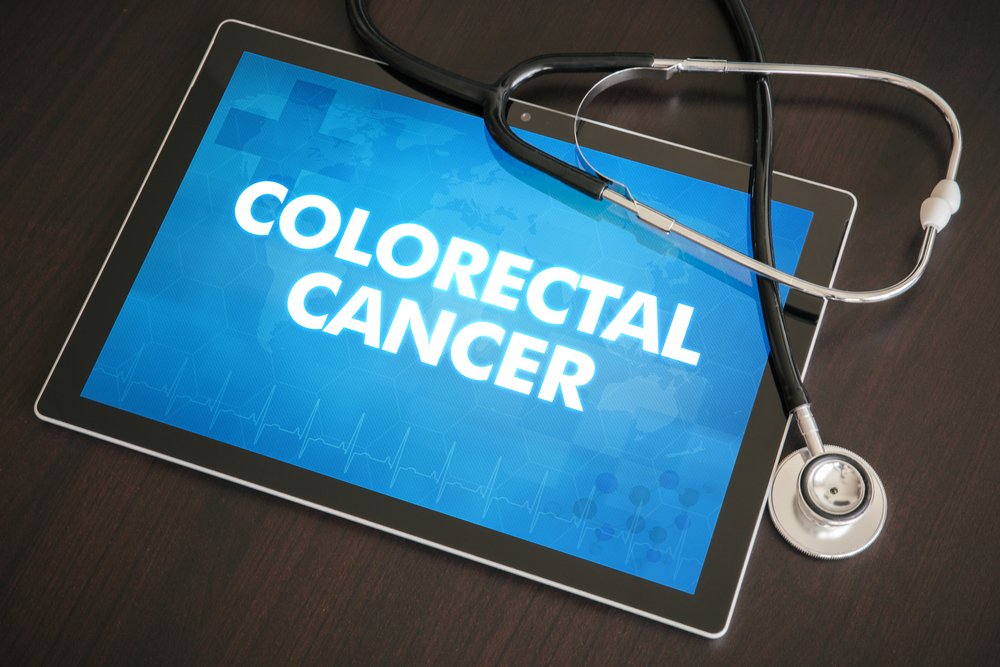 colorectal cancer graphic