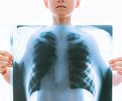 Pediatric lung scans