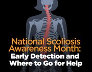 National Scoliosis Awareness Month: Early Detection and Where to Go for Help