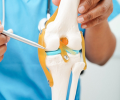 Knee Treatment and Replacement in Fort Myers