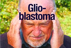 Gioblastoma man holding head
