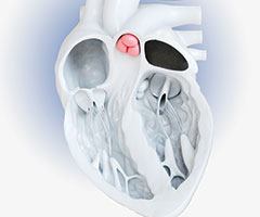 Heart valve model image