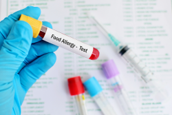 Physician Holding a "Food Allergy" Blood vial to test