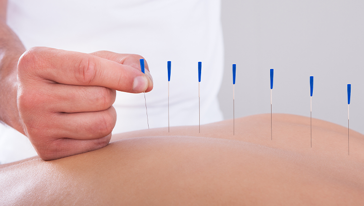Acupuncture Body Content
