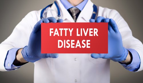 Fatty Liver Disease