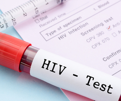 HIV Testing Should be Part of Routine Health Screening