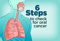 6 Steps to check for oral cancer