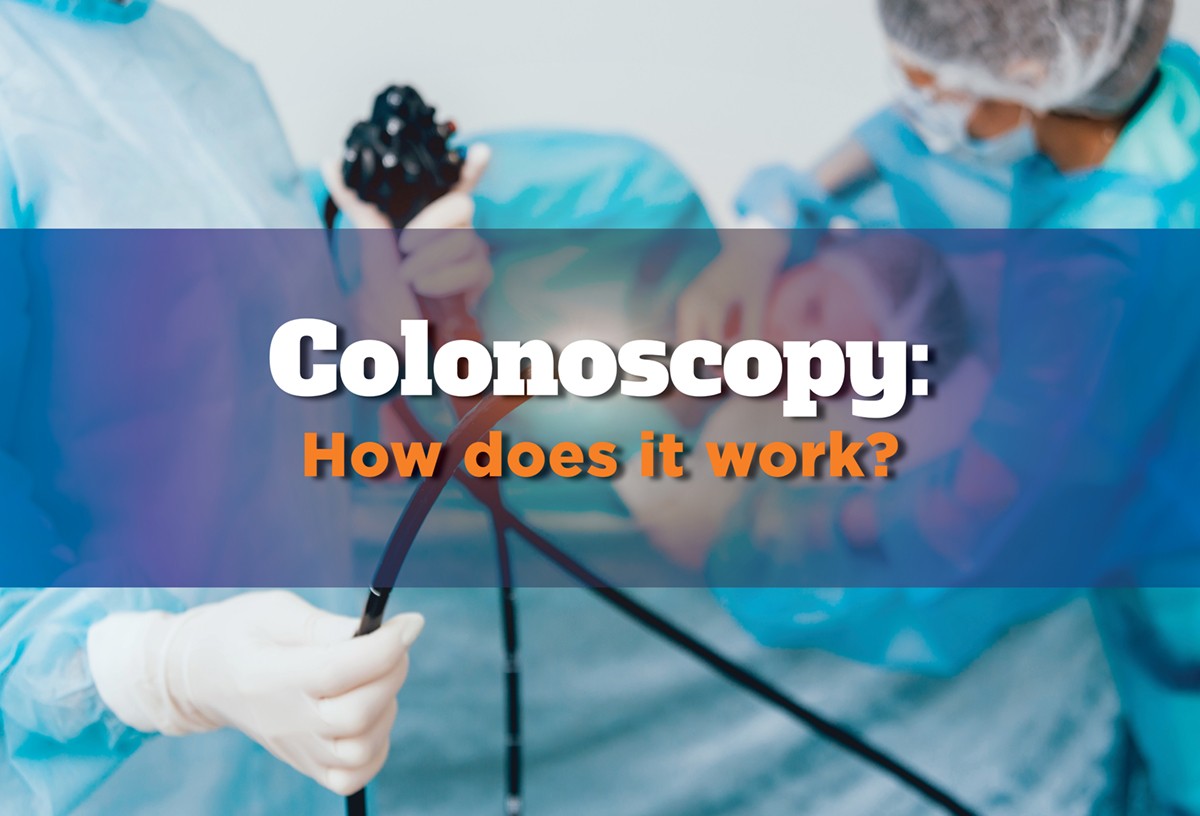 Colonoscopy infographic